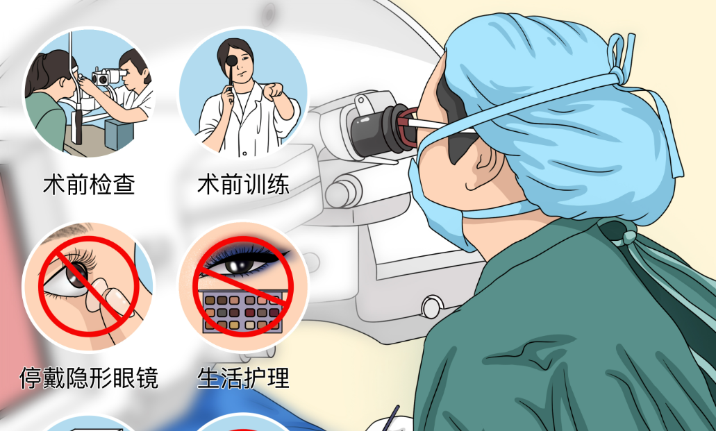 超全近视手术攻略！4种方式详细对比